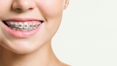 ortodoncia profesionales valencia. Ortodoncia | Especialidades y tratamientos dentales en Valencia');